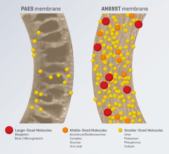 Comparison of AN69 membrane vs PAES membrane