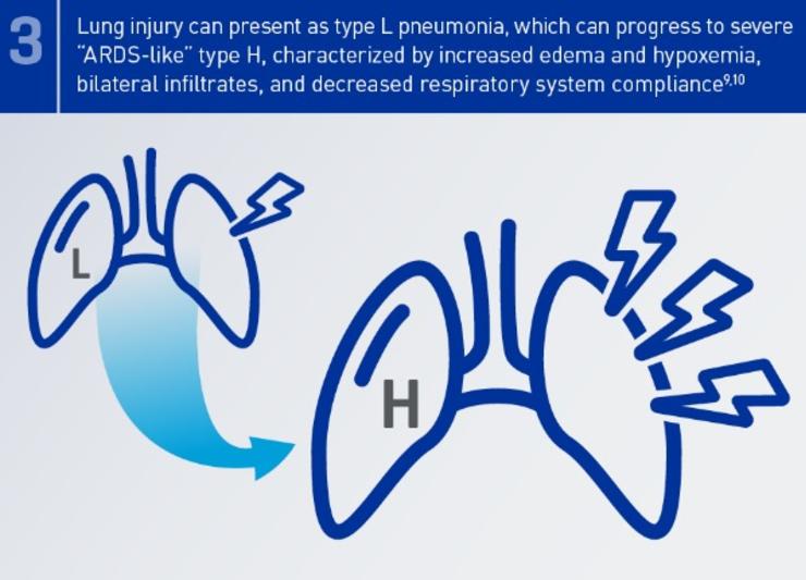 Damaged lungs